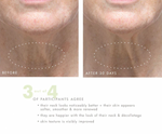 Necks-Level Smooth™ Ultra-Smoothing Triple Effect Neck Cream 1.7 oz